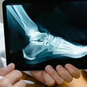 CURSO DE RADIOLOGÍA