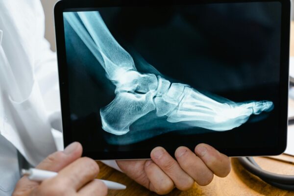 CURSO DE RADIOLOGÍA
