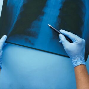 CURSO DE ENFERMEDADES RARAS