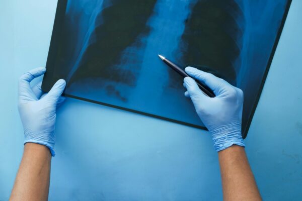 CURSO DE ENFERMEDADES RARAS