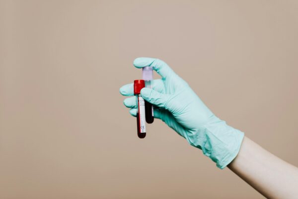 CURSO DE HEMATOLOGÍA