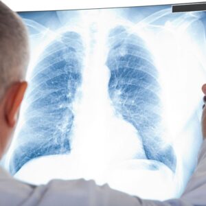 CURSO DE NEUMOLOGÍA