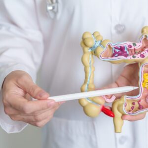 CURSOS DE COLITIS ULCERATIVA