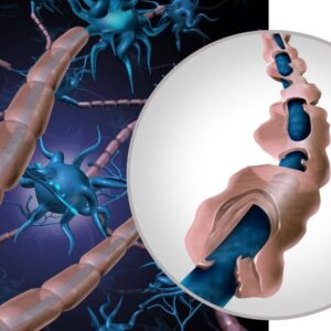 CURSO DE ESCLEROSIS MÚLTIPLE