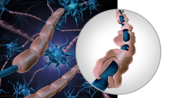 CURSO DE ESCLEROSIS MÚLTIPLE